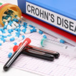 Crohn's Disease: