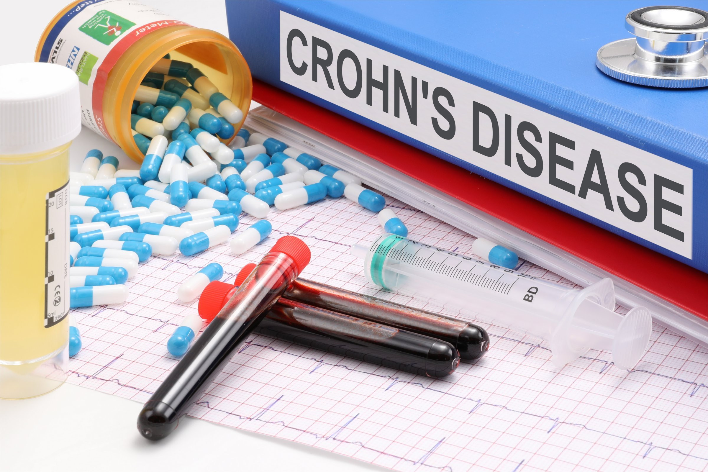 Crohn's Disease: